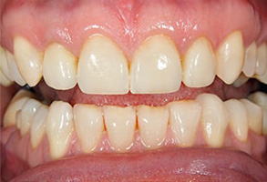 dental images in Astoria