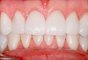 dental images 11105