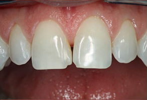 dental images 11105